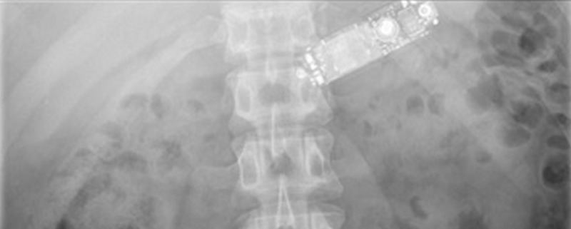 All images: O. Obinwa et al./International Journal of Surgery Case Reports